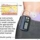 Illustration for article titled Lawmakers call for probe of medical devices after researcher hacks insulin pump